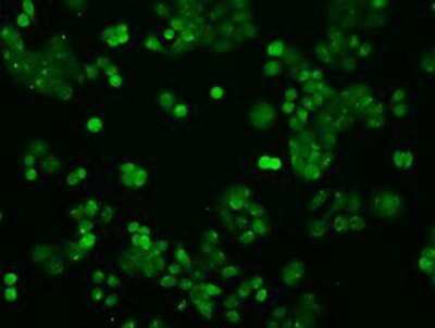 Immunocytochemistry/Immunofluorescence: STAT1 Antibody (4H9) [NBP1-48011] - Immunofluorescent staining of HT29 cells using anti-STAT1 mouse monoclonal antibody.