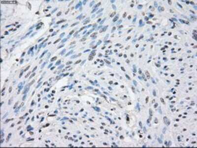 Immunohistochemistry-Paraffin: STAT1 Antibody (4H9) [NBP1-48011] - Staining of paraffin-embedded Human endometrium tissue using anti-STAT1 mouse monoclonal antibody.