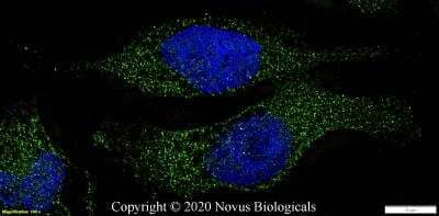 Immunocytochemistry/Immunofluorescence: STAT1 Antibody [NB100-56314] - RH30 cells were fixed in 4% paraformaldehyde for 10 minutes and permeabilized in 0.05% Triton X-100 in PBS for 5 minutes. The cells were incubated with anti-STAT1 Antibody NB100-56314 at 2 ug/ml overnight at 4C and detected with an anti-rabbit Dylight 488 (Green) at a 1:1000 dilution for 60 minutes. Nuclei were counterstained with DAPI (Blue). Cells were imaged using a 100X objective and digitally deconvolved.