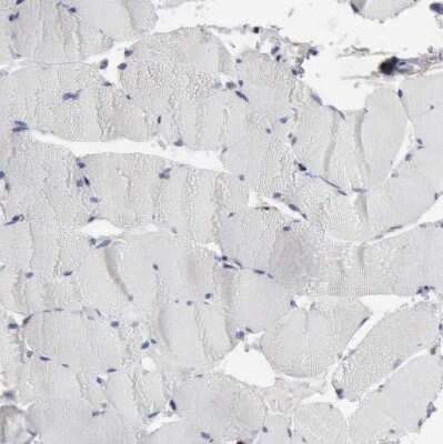 Immunohistochemistry-Paraffin: STAT1 Antibody [NBP1-81578] - Staining of human skeletal muscle shows no positivity in a subset of myocytes as expected.