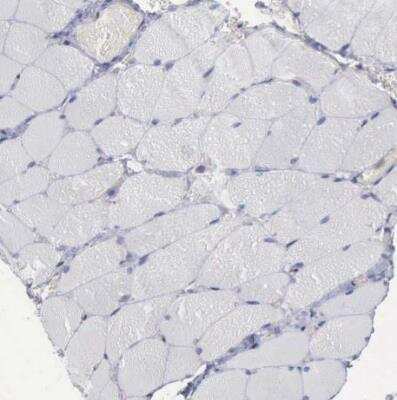 Immunohistochemistry-Paraffin: STAT1 Antibody [NBP1-81579] - Staining of human skeletal muscle shows very weak positivity in myocytes.