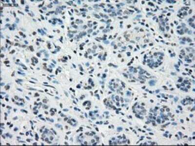 Immunohistochemistry: STAT1 Antibody (OTI4H9) - Azide and BSA Free [NBP2-74375] - Staining of paraffin-embedded Human breast tissue using anti-STAT1 mouse monoclonal antibody.