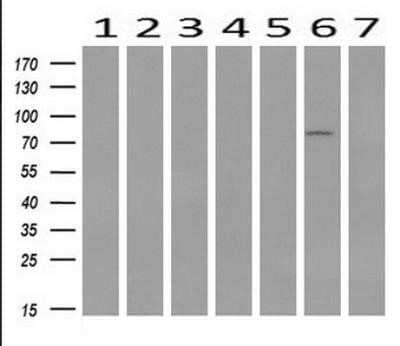 Western Blot: STAT1 Antibody (OTI4H9) - Azide and BSA Free [NBP2-74375] - Analysis of extracts (10ug) from 7 Human tissue by using anti-STAT1 monoclonal antibody ( 1: Uterus; 2: Breast; 3: Brain; 4: Liver; 5: Ovary; 6: Thyroid gland; 7: colon) at 1:200 dilution.