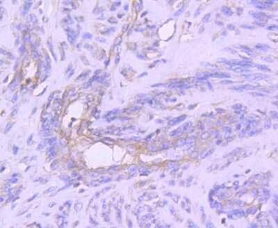 Immunohistochemistry-Paraffin: STAT1 Antibody (SD20-75) [NBP2-67750] - Analysis of paraffin-embedded human cervix uteri tissue using anti-STAT1 alpha antibody. Counter stained with hematoxylin.