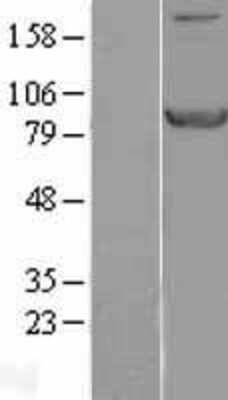 Western Blot: STAT1 Overexpression Lysate (Adult Normal) [NBL1-16524] Left-Empty vector transfected control cell lysate (HEK293 cell lysate); Right -Over-expression Lysate for STAT1.