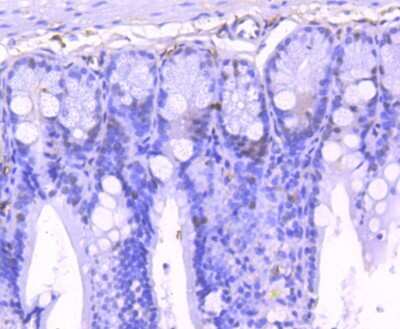 Immunohistochemistry-Paraffin: STAT1 [p Ser727] Antibody (SN67-04) [NBP2-67657] - Analysis of paraffin-embedded mouse colon tissue using anti-Phospho-STAT1(S727) antibody. Counter stained with hematoxylin.