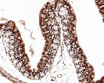 Immunohistochemistry-Paraffin: STAT1 [p Ser727] Antibody (SN67-04) [NBP2-67657] - Analysis of paraffin-embedded mouse colon tissue with Rabbit anti-STAT1 [p Ser727] antibody washed with ddH2O and PBS, and then probed with the primary antibody  at 1/500 dilution for 1 hour at room temperature. The detection was performed using an HRP conjugated compact polymer system. DAB was used as the chromogen. Tissues were counterstained with hematoxylin and mounted with DPX.