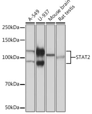 Western Blot: STAT2 Antibody (5Y3W4) [NBP3-16228] - Western blot analysis of extracts of various cell lines, using STAT2 Rabbit mAb (NBP3-16228) at 1:1000 dilution. Secondary antibody: HRP Goat Anti-Rabbit IgG (H+L) at 1:10000 dilution. Lysates/proteins: 25ug per lane. Blocking buffer: 3% nonfat dry milk in TBST. Detection: ECL Basic Kit. Exposure time: 10s.