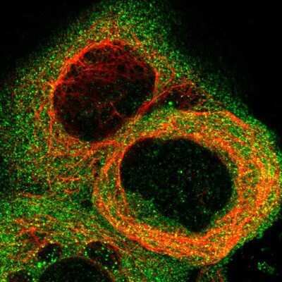 Immunocytochemistry/Immunofluorescence: STAT2 Antibody [NBP1-86991] - Staining of human cell line A-431 shows positivity in plasma membrane and cytoplasm.