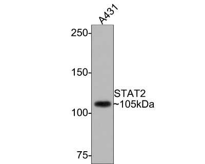 Western Blot: STAT2 Antibody (JF0884) [NBP2-67168] - Analysis of STAT2 on A431 cell lysates with Rabbit anti-STAT2 antibody at 1/500 dilution. Lysates/proteins at 10 ug/Lane. Predicted band size: 98 kDa Observed band size: 105 kDa Exposure time: 1 minute; 6% SDS-PAGE gel. Proteins were transferred to a PVDF membrane and blocked with 5% NFDM/TBST for 1 hour at room temperature. The primary antibody at 1/500 dilution was used in 5% NFDM/TBST at room temperature for 2 hours. Goat Anti-Rabbit IgG - HRP Secondary Antibody at 1:300,000 dilution was used for 1 hour at room temperature.