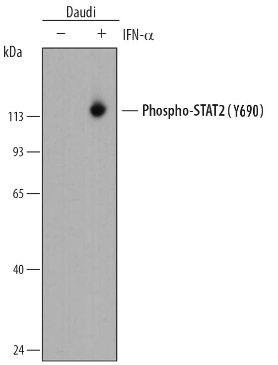 Western blot shows lysates of Daudi human Burkitt's lymphoma cell line untreated (-) or treated (+) with 500 U/mL Recombinant Human IFN-aA (11100-1) for 20 minutes. PVDF membrane was probed with 0.05 µg/mL of Rabbit Anti-Human Phospho-STAT2 (Y690) Monoclonal Antibody (Catalog # MAB2890) followed by HRP-conjugated Anti-Rabbit IgG Secondary Antibody (HAF008). A specific band was detected for Phospho-STAT2 (Y690) at approximately 113 kDa (as indicated). This experiment was conducted under reducing conditions and using Immunoblot Buffer Group 1.