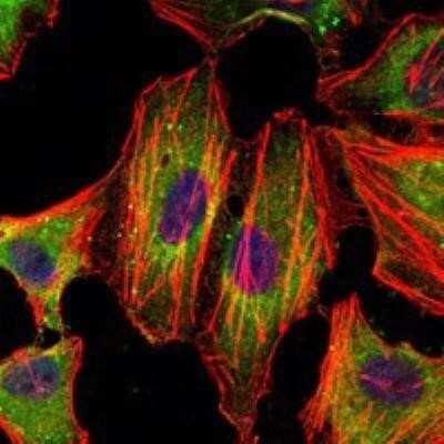 Immunocytochemistry/Immunofluorescence: STAT3 Antibody (3B5) [NBP1-51667] - Analysis of Hela cells using STAT3 mouse mAb (green). Blue: DRAQ5 fluorescent DNA dye. Red: Actin filaments have been labeled with Alexa Fluor-555 phalloidin.