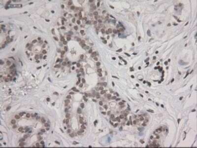 Immunohistochemistry: STAT3 Antibody (OTI21E7) - Azide and BSA Free [NBP2-74378] - Staining of paraffin-embedded breast using anti-STAT3 mouse monoclonal antibody.