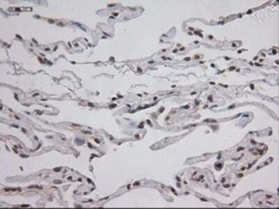 Immunohistochemistry: STAT3 Antibody (OTI21E7) - Azide and BSA Free [NBP2-74378] - Staining of paraffin-embedded lung using anti-STAT3 mouse monoclonal antibody.