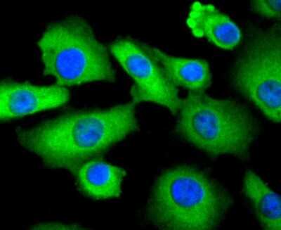 Immunocytochemistry/Immunofluorescence: STAT3 Antibody (SY34-01) [NBP2-67392] - Staining STAT3 in A549 cells (green). The nuclear counter stain is DAPI (blue). Cells were fixed in paraformaldehyde, permeabilised with 0.25% Triton X100/PBS.