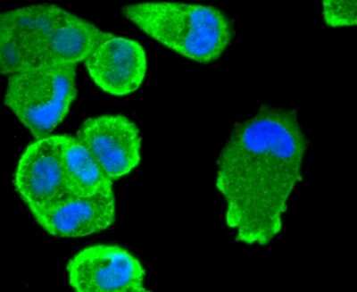 Immunocytochemistry/Immunofluorescence: STAT3 Antibody (SY34-01) [NBP2-67392] - Staining STAT3 in Hela cells (green). The nuclear counter stain is DAPI (blue). Cells were fixed in paraformaldehyde, permeabilised with 0.25% Triton X100/PBS.