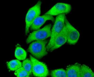 Immunocytochemistry/Immunofluorescence: STAT3 Antibody (SY34-01) [NBP2-67392] - Staining STAT3 in HepG2 cells (green). The nuclear counter stain is DAPI (blue). Cells were fixed in paraformaldehyde, permeabilised with 0.25% Triton X100/PBS.