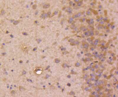 Immunohistochemistry-Paraffin: STAT3 Antibody (SY34-01) [NBP2-67392] - Analysis of paraffin-embedded mouse brain tissue using anti-STAT3 antibody. Counter stained with hematoxylin.