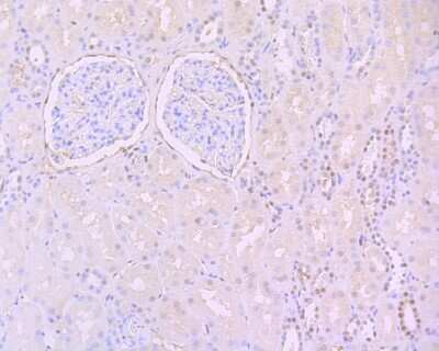 Immunohistochemistry-Paraffin: STAT3 [p Tyr705] Antibody (SZ43-01) [NBP2-67367] - Immunohistochemical analysis of paraffin-embedded human kidney tissue using anti-STAT3 antibody. The section was pre-treated using heat mediated antigen retrieval with Tris-EDTA buffer (pH 8.0-8.4) for 20 minutes. The tissues were blocked in 5% BSA for 30 minutes at room temperature, washed with ddH2O and PBS, and then probed with the primary antibody (ET1603-40, 1/50) for 30 minutes at room temperature. The detection was performed using an HRP conjugated compact polymer system. DAB was used as the chromogen. Tissues were counterstained with hematoxylin and mounted with DPX.