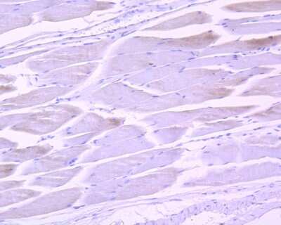 Immunohistochemistry-Paraffin: STAT3 [p Tyr705] Antibody (SZ43-01) [NBP2-67367] - Immunohistochemical analysis of paraffin-embedded mouse skeletal muscle tissue using anti-STAT3 antibody. The section was pre-treated using heat mediated antigen retrieval with Tris-EDTA buffer (pH 8.0-8.4) for 20 minutes. The tissues were blocked in 5% BSA for 30 minutes at room temperature, washed with ddH2O and PBS, and then probed with the primary antibody (ET1603-40, 1/50) for 30 minutes at room temperature. The detection was performed using an HRP conjugated compact polymer system. DAB was used as the chromogen. Tissues were counterstained with hematoxylin and mounted with DPX.