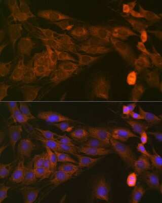 Immunocytochemistry/Immunofluorescence: STAT4 Antibody (10H10O9) [NBP3-16425] - Immunofluorescence analysis of C6 cells using STAT4 Rabbit mAb (NBP3-16425) at dilution of 1:100 (40x lens). Blue: DAPI for nuclear staining.