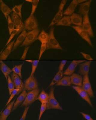 Immunocytochemistry/Immunofluorescence: STAT4 Antibody (10H10O9) [NBP3-16425] - Immunofluorescence analysis of NIH-3T3 cells using STAT4 Rabbit mAb (NBP3-16425) at dilution of 1:100 (40x lens). Blue: DAPI for nuclear staining.