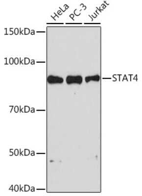 Western Blot: STAT4 Antibody (10H10O9) [NBP3-16425] - Western blot analysis of extracts of various cell lines, using STAT4 Rabbit mAb (NBP3-16425) at 1:1000 dilution. Secondary antibody: HRP Goat Anti-Rabbit IgG (H+L) at 1:10000 dilution. Lysates/proteins: 25ug per lane. Blocking buffer: 3% nonfat dry milk in TBST. Detection: ECL Basic Kit. Exposure time: 90s.