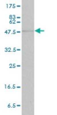 Western Blot: STAT4 Antibody (1C2-1C12) [H00006775-M01] - STAT4 monoclonal antibody (M01), clone 1C2-1C12. Analysis of STAT4 expression in human liver.