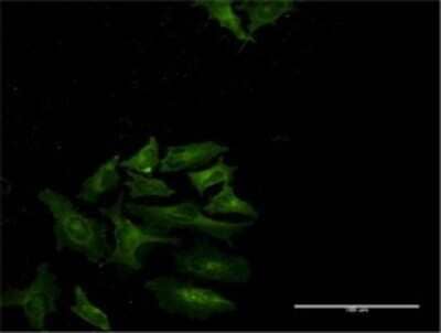 Immunocytochemistry/Immunofluorescence: STAT4 Antibody (2H4-1G8) [H00006775-M02] - Analysis of monoclonal antibody to STAT4 on HeLa cell . Antibody concentration 10 ug/ml.