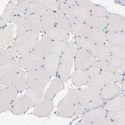 Immunohistochemistry-Paraffin: STAT4 Antibody [NBP1-89474] - Staining of human skeletal muscle shows low expression as expected.