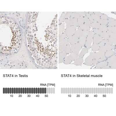 Immunohistochemistry-Paraffin: STAT4 Antibody [NBP1-89474] - Staining in human testis and skeletal muscle tissues using anti-STAT4 antibody. Corresponding STAT4 RNA-seq data are presented for the same tissues.