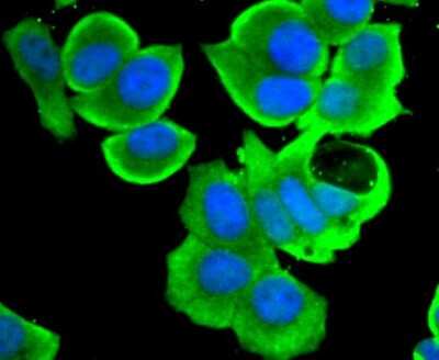Immunocytochemistry/Immunofluorescence: STAT4 Antibody (JJ08-85) [NBP2-67868] - Staining STAT4 in MCF-7 cells (green). The nuclear counter stain is DAPI (blue). Cells were fixed in paraformaldehyde, permeabilised with 0.25% Triton X100/PBS.
