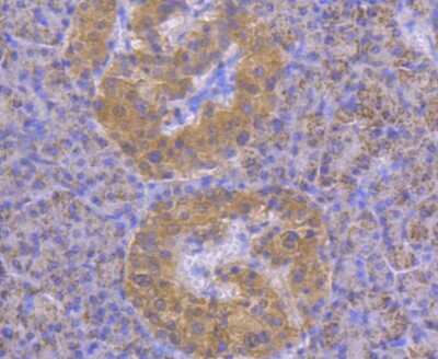 Immunohistochemistry-Paraffin: STAT4 Antibody (JJ08-85) [NBP2-67868] - Analysis of paraffin-embedded human pancreas tissue using anti-STAT4 antibody. Counter stained with hematoxylin.