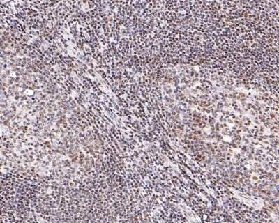 Immunohistochemistry-Paraffin: STAT4 Antibody (JJ08-85) [NBP2-67868] - Analysis of paraffin-embedded human tonsils tissue with Rabbit anti-STAT4 antibody washed with ddH2O and PBS, and then probed with the primary antibody  at 1/400 dilution for 1 hour at room temperature. The detection was performed using an HRP conjugated compact polymer system. DAB was used as the chromogen. Tissues were counterstained with hematoxylin and mounted with DPX.
