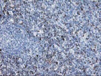 Immunohistochemistry: STAT4 Antibody (OTI2F3) - Azide and BSA Free [NBP2-74389] - Staining of paraffin-embedded Human tonsil using anti-STAT4 mouse monoclonal antibody.