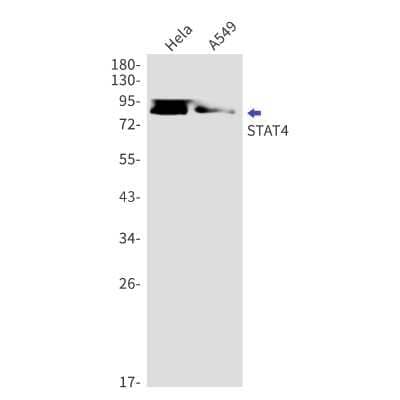 Western Blot: STAT4 Antibody (S02-1C1) [NBP3-14977] - Western blot detection of STAT4 in Hela, A549 cell lysates using STAT4 Rabbit mAb (1:1000 diluted). Predicted band size: 86kDa. Observed band size: 86kDa.