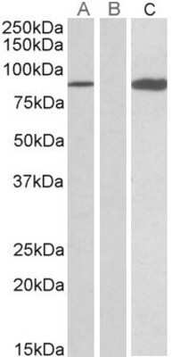 Western Blot: STAT4 Antibody [NBP1-49836] - HEK293 lysate (10ug protein in RIPA buffer) overexpressing Human STAT4 (RC206892) with C-terminal MYC tag probed with EB09861 (0.5ug/ml) in Lane A and probed with anti-MYC Tag (1/1000) in lane C. Mock-transfected HEK293 probed with EB09861 (1mg/ml) in Lane B. Primary incubations were for 1 hour. Detected by chemiluminescence.