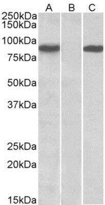 Western Blot: STAT4 Antibody [NBP1-49837] - HEK293 lysate (10ug protein in RIPA buffer) overexpressing Human STAT4 with C-terminal MYC tag probed with (1ug/ml) in Lane A and probed with anti-MYC Tag (1/1000) in lane C. Mock-transfected HEK293 probed with (1mg/ml) in Lane B. Primary incubations were