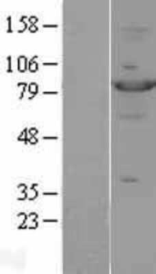 Western Blot: STAT4 Overexpression Lysate (Adult Normal) [NBL1-16527] Left-Empty vector transfected control cell lysate (HEK293 cell lysate); Right -Over-expression Lysate for STAT4.