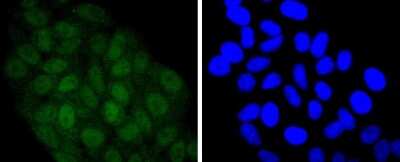 Immunocytochemistry/Immunofluorescence: STAT5A Antibody (JJ08-78) [NBP2-67871] - Staining STAT5A+B in HepG2 cells (green). The nuclear counter stain is DAPI (blue). Cells were fixed in paraformaldehyde, permeabilised with 0.25% Triton X100/PBS.