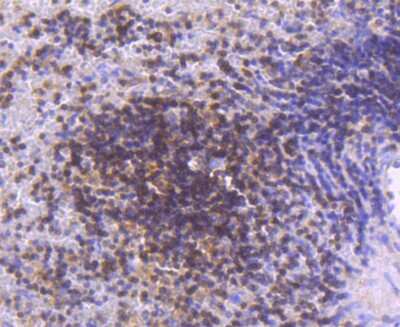 Immunohistochemistry-Paraffin: STAT5A Antibody (JJ08-78) [NBP2-67871] - Analysis of paraffin-embedded human spleen tissue using anti-STAT5A+B antibody. Counter stained with hematoxylin.