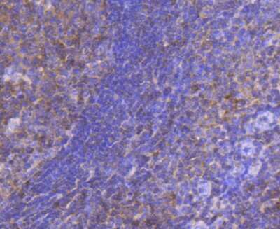 Immunohistochemistry-Paraffin: STAT5A Antibody (JJ08-78) [NBP2-67871] - Analysis of paraffin-embedded human tonsil tissue using anti-STAT5A+B antibody. Counter stained with hematoxylin.