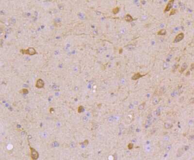 Immunohistochemistry-Paraffin: STAT5A Antibody (JJ08-78) [NBP2-67871] - Analysis of paraffin-embedded mouse brain tissue using anti-STAT5A+B antibody. Counter stained with hematoxylin.