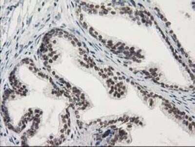 Immunohistochemistry: STAT5A Antibody (OTI9F7) - Azide and BSA Free [NBP2-74392] - Staining of paraffin-embedded Human prostate tissue using anti-STAT5A mouse monoclonal antibody.