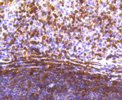 Immunohistochemistry-Paraffin: STAT5A Antibody (SC66-09) [NBP2-67601] - Analysis of paraffin-embedded human tonsil tissue using anti-STAT5a antibody. Counter stained with hematoxylin.