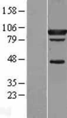 Western Blot STAT5A Overexpression Lysate