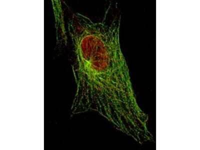 Immunocytochemistry/Immunofluorescence: STAT5A [p Tyr694] Antibody (5F6.F1) [NBP1-77817] - Used at a 1:500 dilution detecting Stat5 in 3T3 cells (immunofluorescent STED microscopy). Red represents Stat5 pY694 protein. Green represents tubulin.