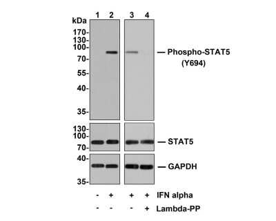 Western Blot: STAT5A [p Tyr694] Antibody (SC05-31) [NBP2-67590] - Analysis of STAT5A [p Tyr694] on Hela cell lysates. Lane 1: Hela cells, whole cell lysate, 10ug/lane Lane 2/3: Hela cells treated with 100ng/mL IFN alpha for 60 minutes, whole cell lysates, 10ug/lane Lane 4: Hela cells treated with 100ng/mL IFN alpha for 60 minutes, then treated with 2.8ug/ul lambda-PP for 30 minutes, whole cell lysates, 10ug/lane All lanes : Anti-STAT5A [p Tyr694] antibody at 1:500 dilution. Anti-STAT5 antibody at 1:500 dilution. Anti-GAPDH antibody at 1:10,000 dilution. Goat Anti-Rabbit IgG H&L (HRP) at 1/200,000 dilution. Predicted band size: 91 kDa Observed band size: 91 kDa Blocking and diluting buffer: 5% BSA. Exposure time: 2 minutes 2 seconds
