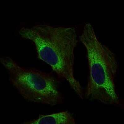 Immunocytochemistry/Immunofluorescence: STAT5a Antibody (6D4) [NBP2-37441] - Immunofluorescence analysis of Hela cells using STAT5A mouse mAb (green). Blue: DRAQ5 fluorescent DNA dye.