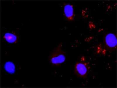 Proximity Ligation Assay: STAT5a Antibody [H00006776-D01P] - Analysis of protein-protein interactions between STAT5A and SHC1. Mahlavu cells were stained with anti-STAT5A rabbit purified polyclonal 1:1200 and anti-SHC1 mouse monoclonal antibody 1:50. Each red dot represents the detection of protein-protein interaction complex, and nuclei were counterstained with DAPI (blue).
